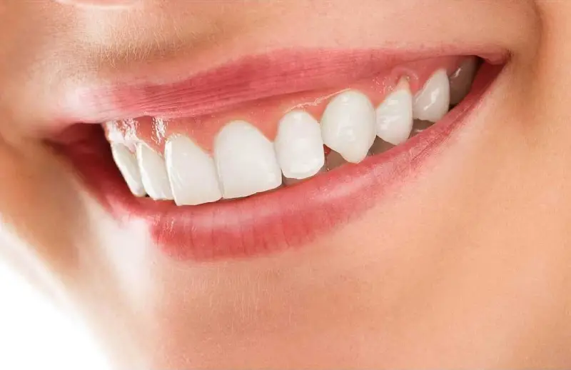 Diş eti çekilmesi — diş eti seviyesindeki gerilemeyi aynada kontrol eden hasta