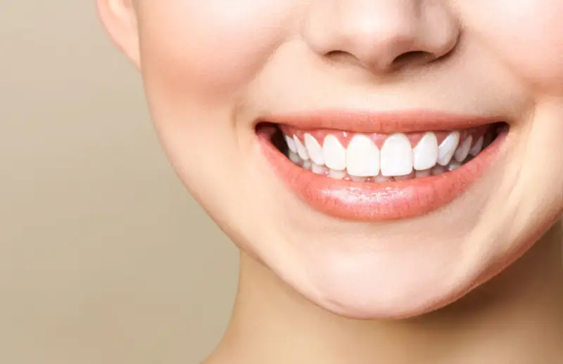 Gummy smile — gülümseme sırasında üst diş etleri belirgin görünen bir gülüşün yakın çekimi