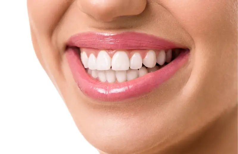 Periodontal tedavi — diş eti muayenesinde sond ile cep derinliği ölçümü